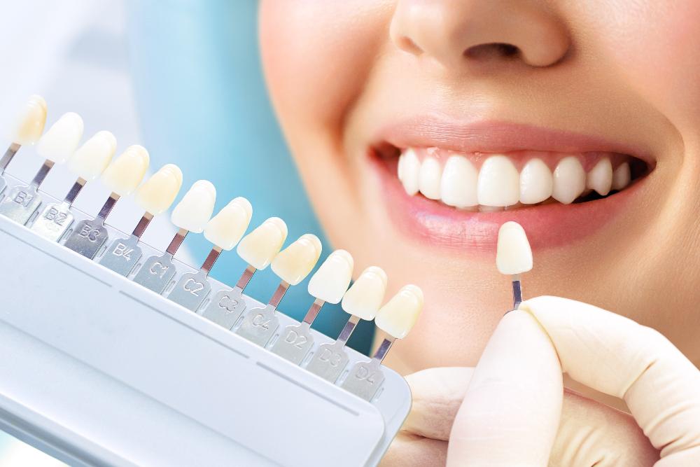 teeth whitening in knoxville