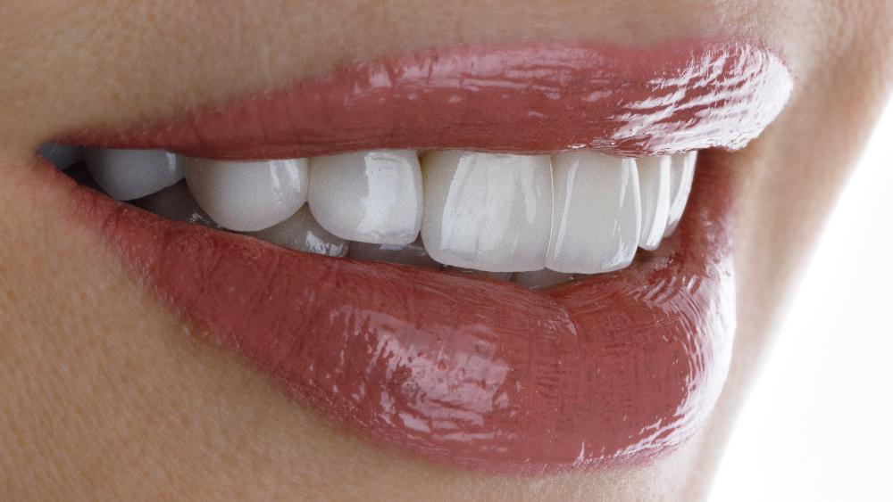 woman with porcelain veneers in knoxville