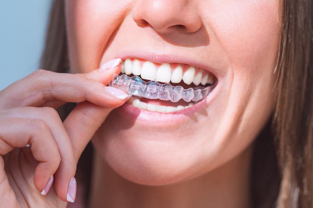 teeth whitening in knoxville tn