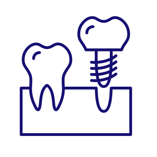 image or a dental implant in knoxville