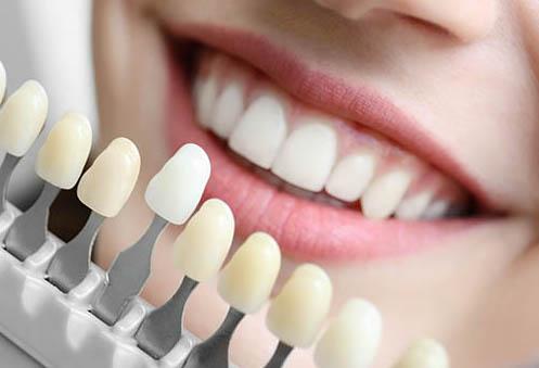 tooth fillings in knoxville
