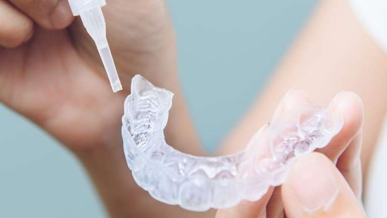 teeth whitening in knoxville