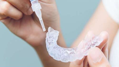 An image of clear aligner being cleaned to prevent discoloration in Knoxville, TN