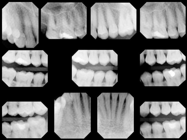 digital x-rays in knoxville tn